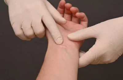 Patru ingrediente simple care iti schimba tenul. Ce se intampla cu cicatricile vechi