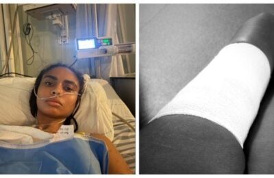 Laurette avertizează femeile despre riscurile aquafillingului după o nouă operație
